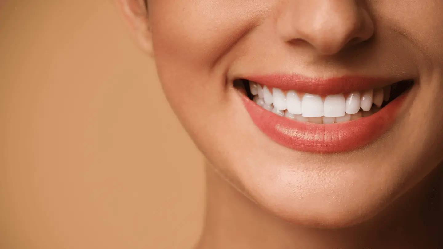 Buzëqeshja perfekte në pak hapa: si fasetat E-max po revolucionarizojnë estetikën dentare