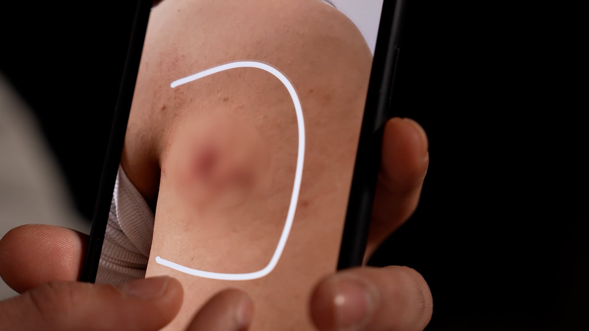 Pa kontratë dhe me pretendime se u sulmua fizikisht – rrëfimi i punëtorit që akuzon drejtorin për dhunë në vendin e punës