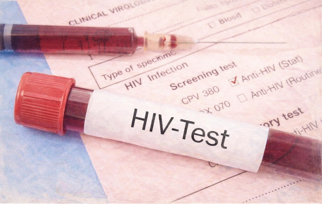 Rritje e përdorimit të barnave parandaluese kundër HIV në QKUK